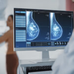 dense breast tissue Silver Spring