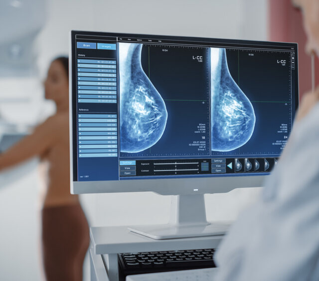 dense breast tissue Silver Spring