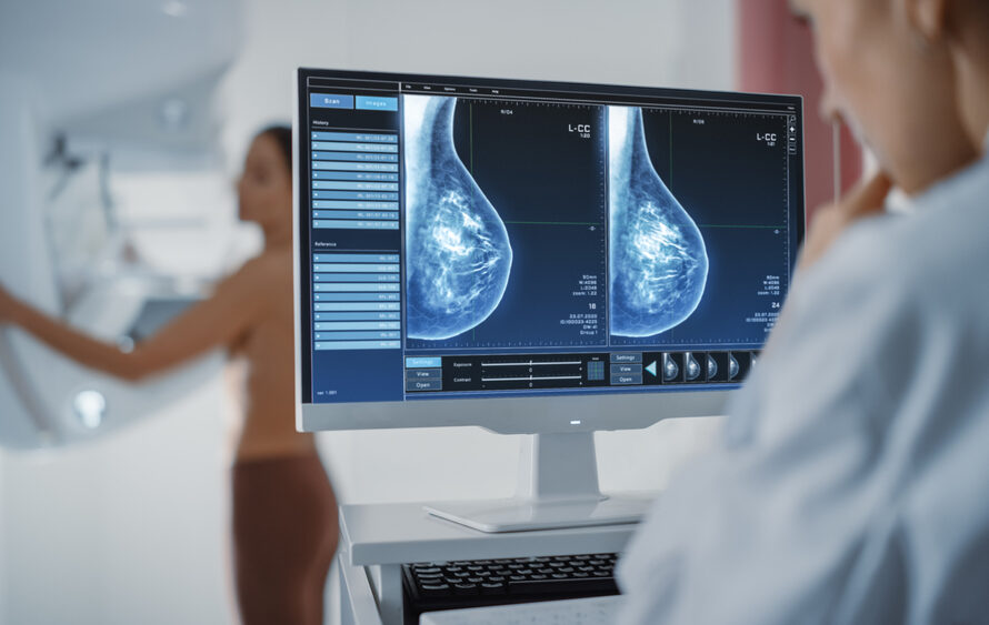 dense breast tissue Silver Spring
