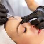 Botox Silver Spring Maryland