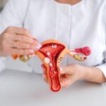 doctor showing model with cervical polyps in Silver Spring