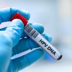 abnormal HPV results in Montgomery County