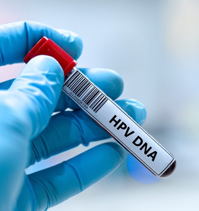 abnormal HPV results in Montgomery County
