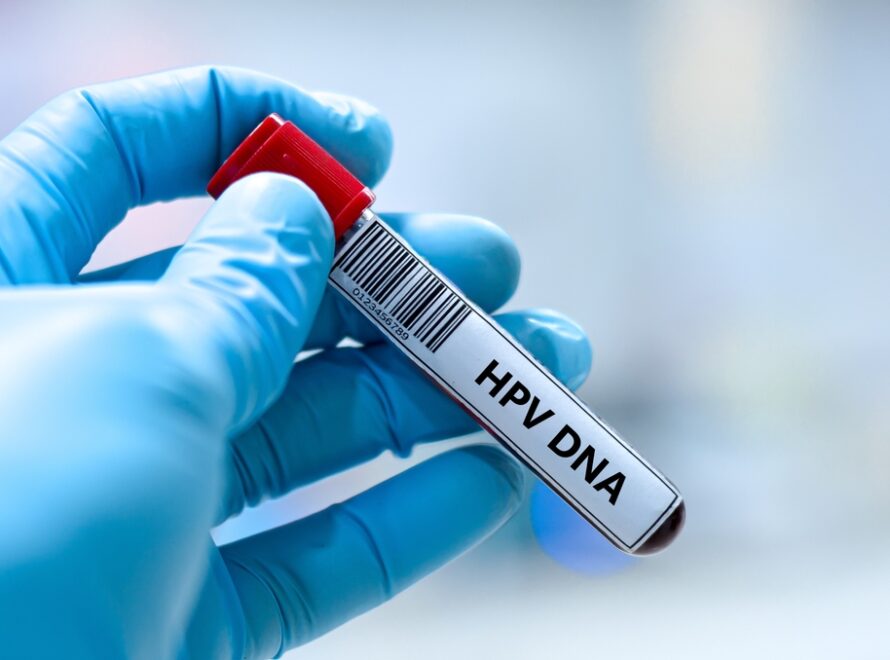 abnormal HPV results in Montgomery County