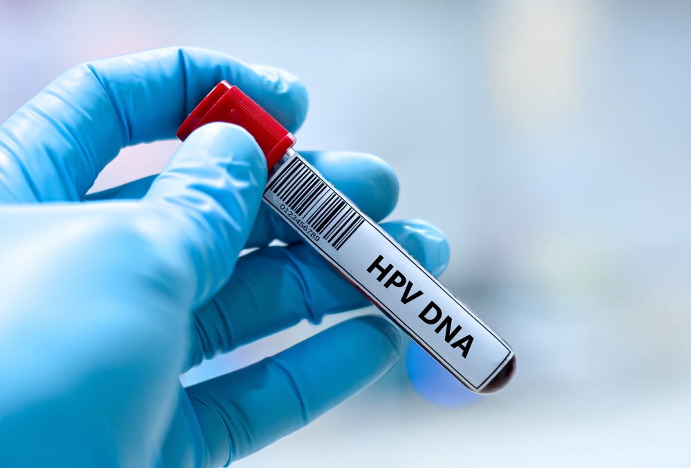 abnormal HPV results in Montgomery County